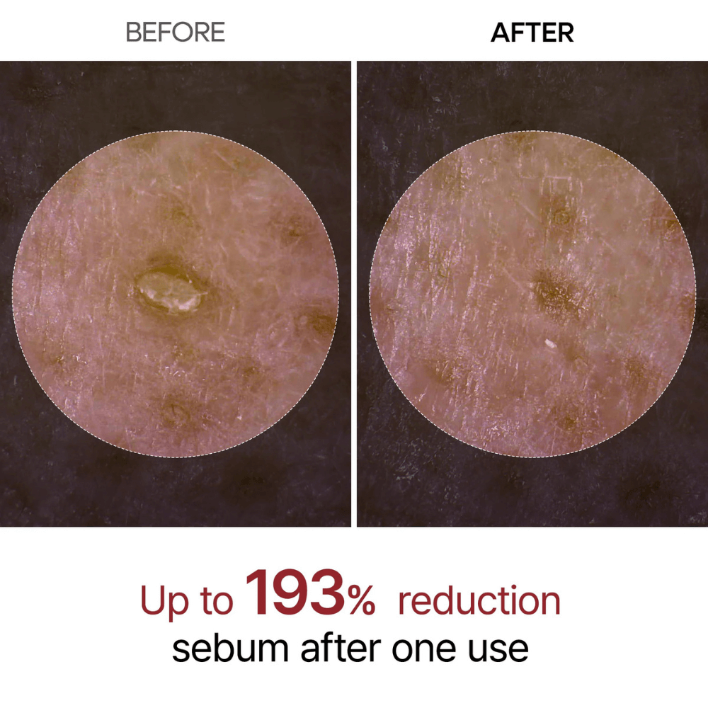 Glamio® Peel Shot Glow Rice Ampoule Duo