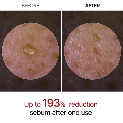 Glamio® Peel Shot Glow Rice Ampoule Duo